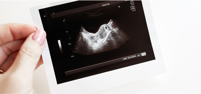 Ecografía 1